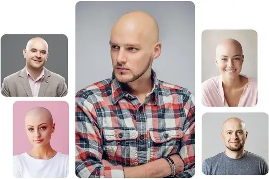 Bald Filter for anyone